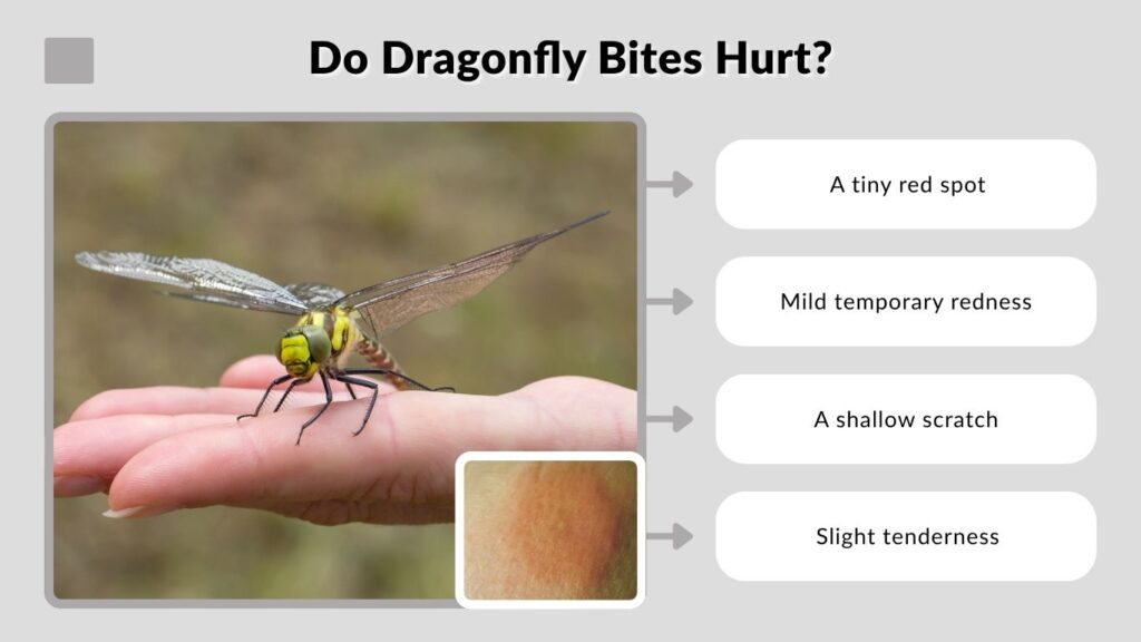 Do Dragonfly Bites Hurt?