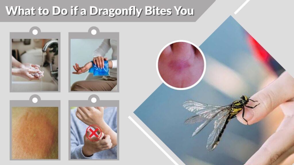 What to Do if a Dragonfly Bites You